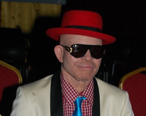 Albinisme le monde entier fête en 2019