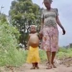 RDC 1 million d'enfants courent un risque de malnutrition aiguë