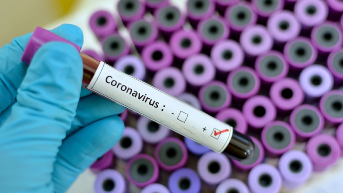 Coronavirus _covid 19 rdc inrb
