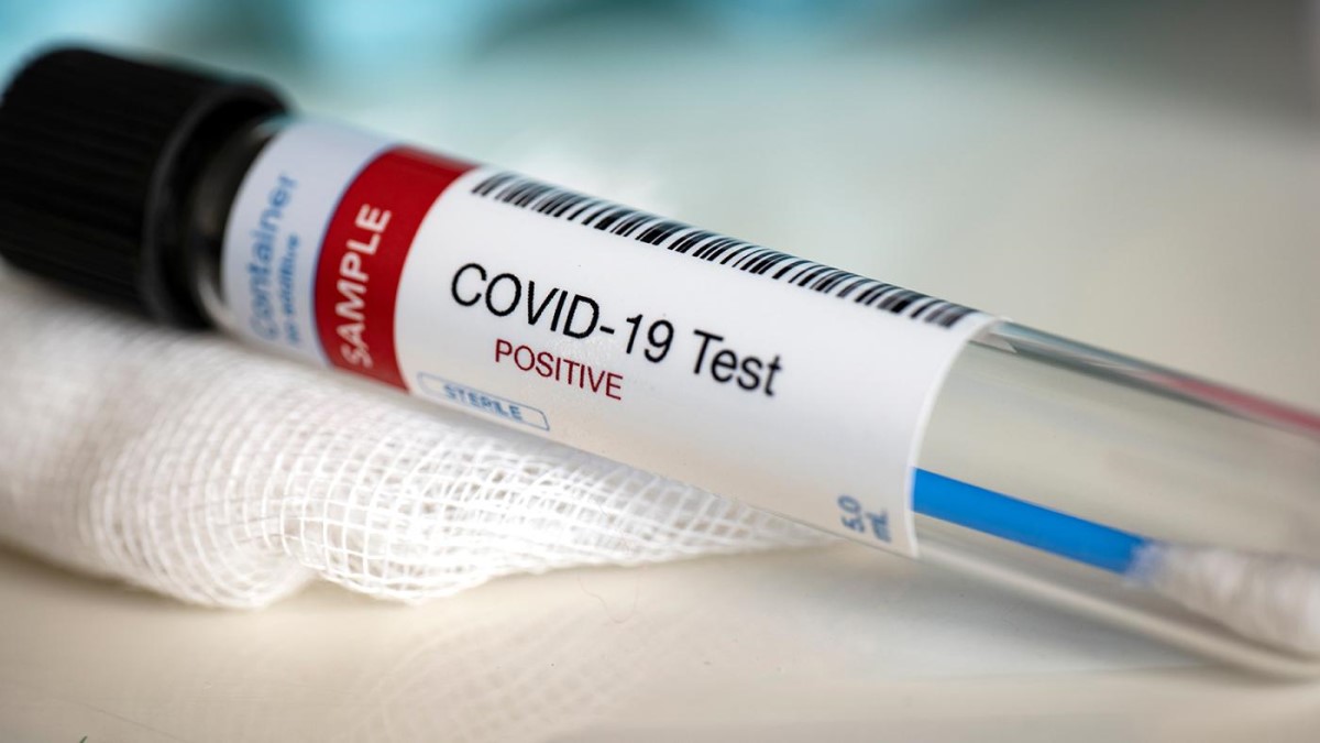 RDC : Suspension de test Covid-19 à l’entrée et à la sortie du territoire pour les personnes complètement vaccinées