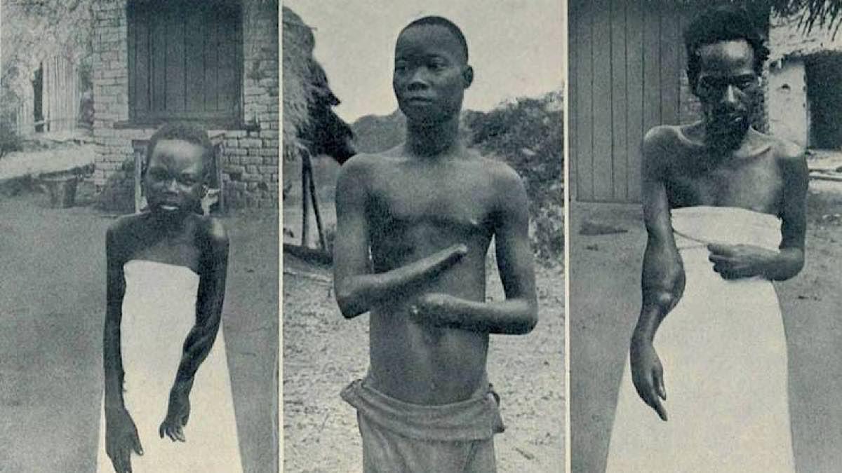 RDC – 60 ans d’indépendance : La Belgique devrait présenter ses excuses aux congolais pour les atrocités commises par Léopold II dans l’ancienne colonie belge