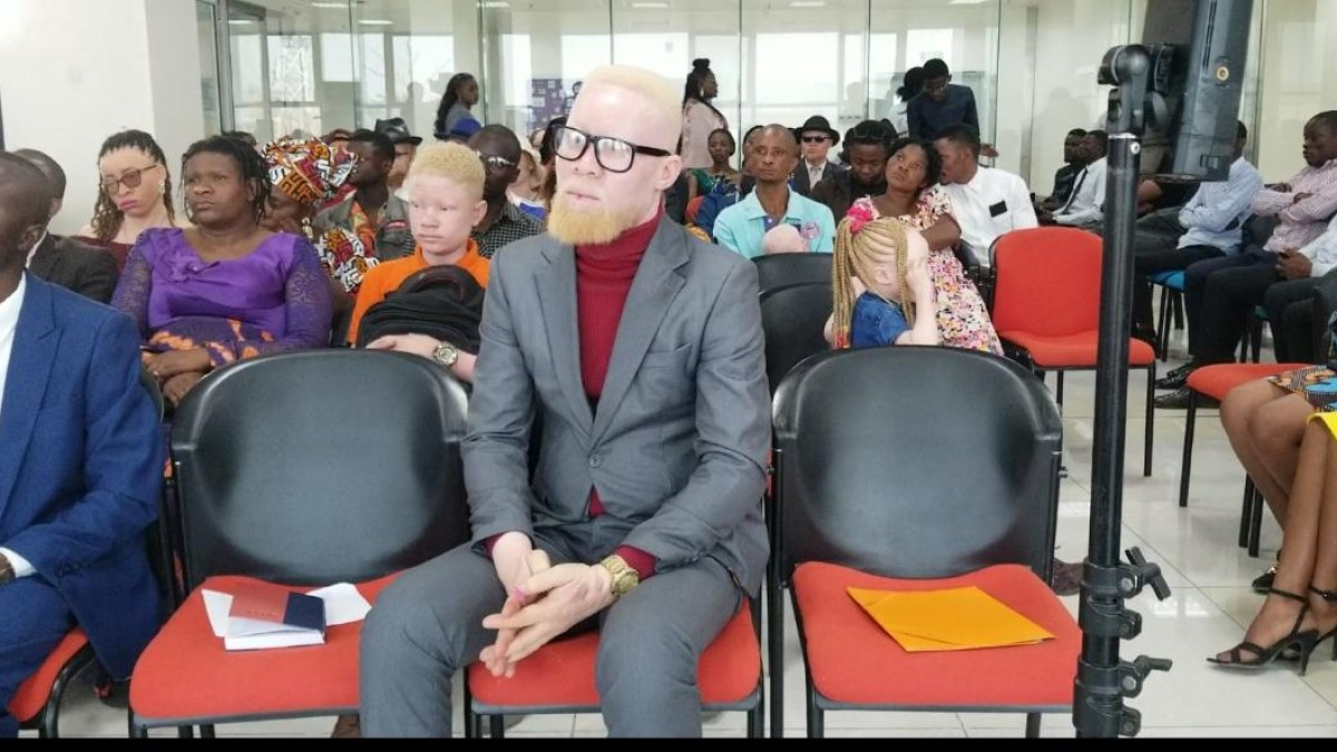 Lubumbashi Sensibilisation des albinos