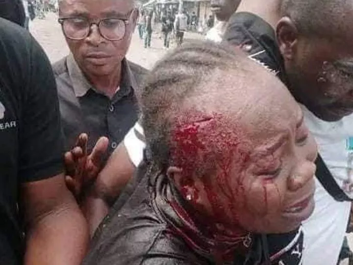 L’ambassade américaine en RDC condamne l’usage disproportionné de la force lors des manifestations du 20 mai