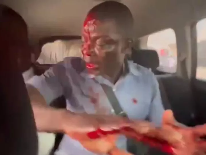 Élection Présidentielle RDC: Plusieurs Blessés dans des Troubles lors d’un Rassemblement de Moïse Katumbi à Muanda